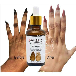 DR MEINAIER Serum For Hyperpigmentation Dark Knuckle Elbow Knee