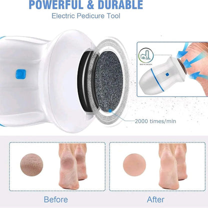 Rechargeable Find Back Callus Remover With Built-In Vacuum Foot Grinder Machine Hard Crack Cleaning