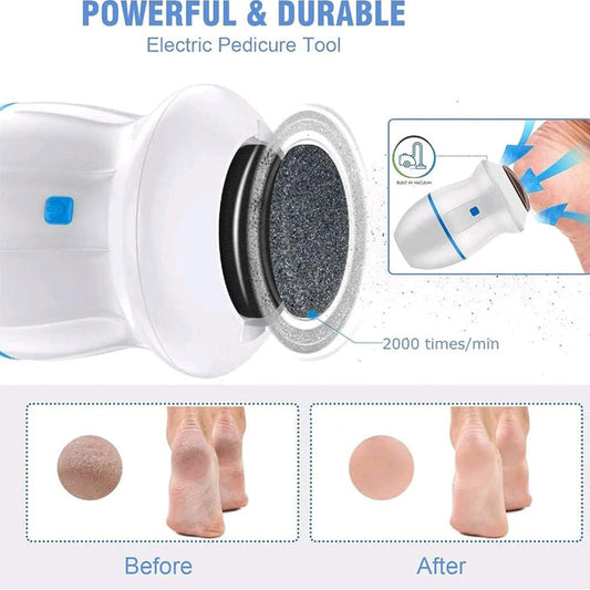 Rechargeable Find Back Callus Remover With Built-In Vacuum Foot Grinder Machine Hard Crack Cleaning
