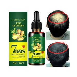 Aichun 7 Days Hair Tonic, Growth Oil, Ginger ,anti-hair Loss