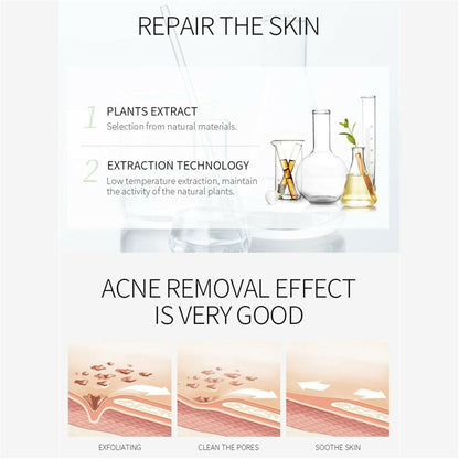 Aichun Beauty Anti-Acne Cleaning Cream