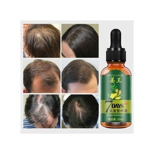 Aichun Beauty 7 Days King Of Ginger Germinal Hair Oil Growth Essence - 30ml