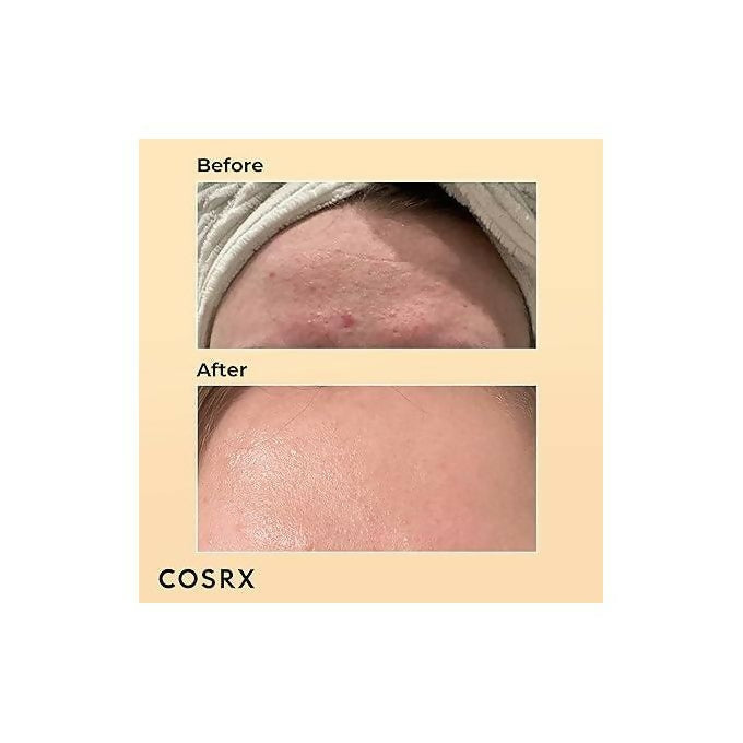 COSRX Advanced Snail 96 Mucin Power Essence.