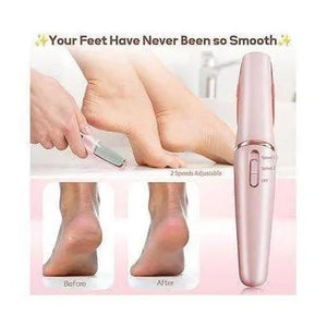 New electric callous remover