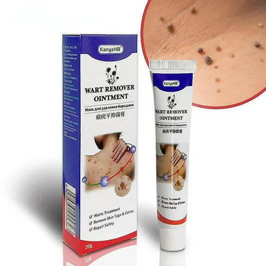 Warts Remover Ointment – Fast & Natural Treatment for Warts, Moles, Skin Tags & Corns